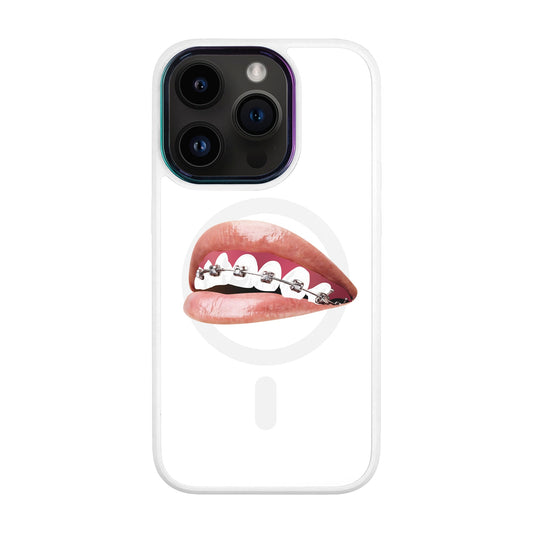 ORTHODONTİST-Vigor Kılıf MagSafe Özellikli - iPhone 14 Pro