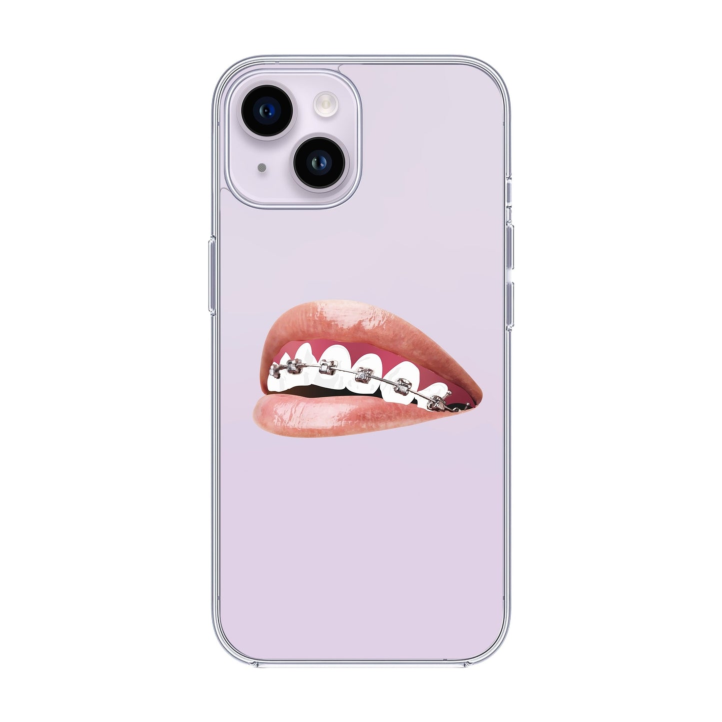 ORTHODONTIST-iPhone 14 Solid Kılıf