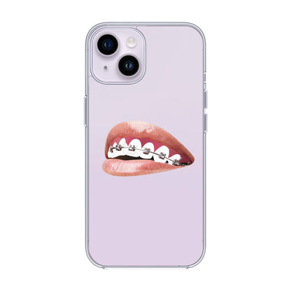ORTHODONTIST-iPhone 14 Solid Kılıf