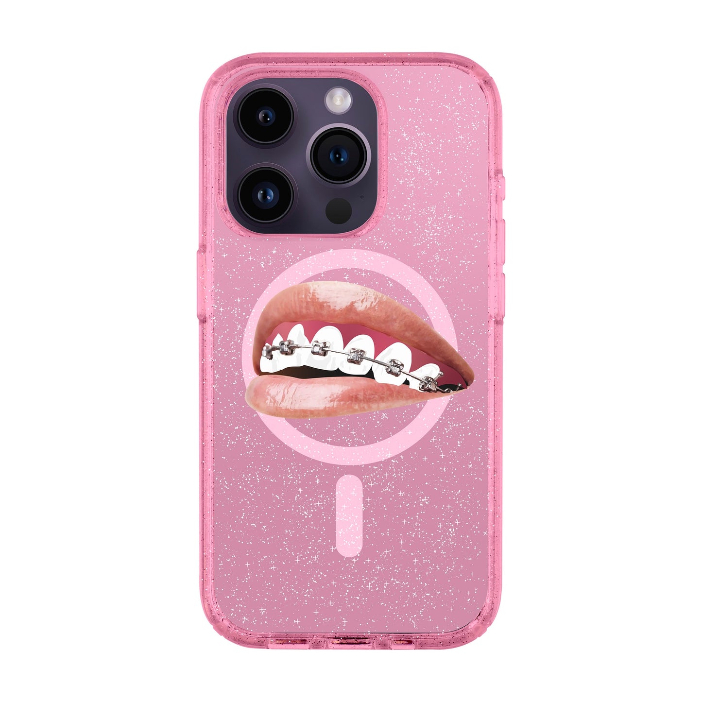 ORTHODONTIST-iPhone 14 Pro Shiny Kılıf MagSafe Özellikli