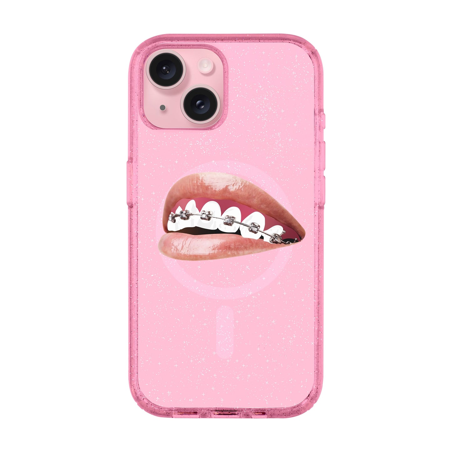 ORTHODONTIST-iPhone 15 Plus Shiny Kılıf MagSafe Özellikli