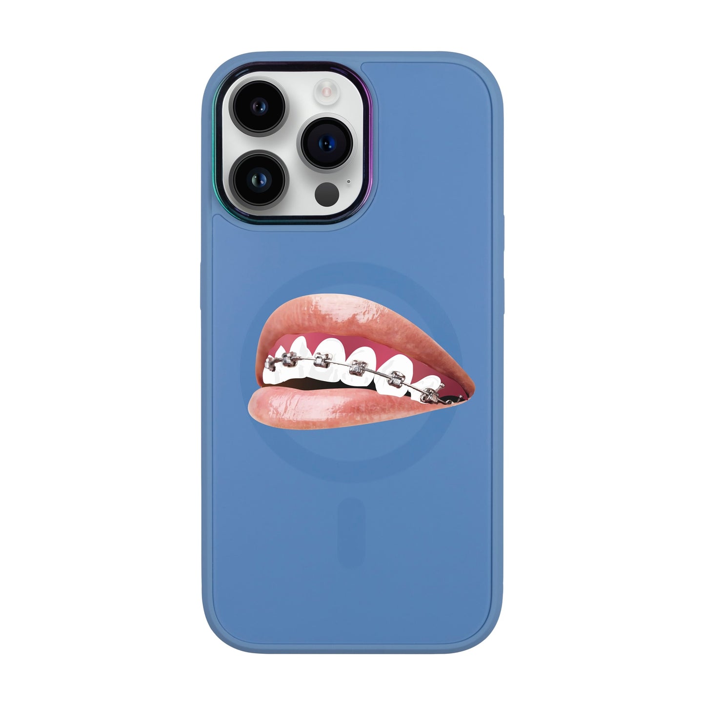 ORTHODONTİST-iPhone 14 Pro Max Vigor Kılıf MagSafe Özellikli