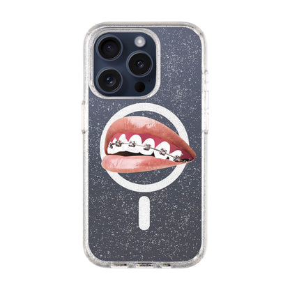 ORTHODONTIST-iPhone 15 Pro Shiny Kılıf MagSafe Özellikli