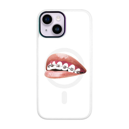 ORTHODONTİST-iPhone 12 Vigor Kılıf MagSafe Özellikli