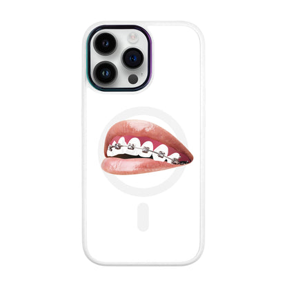 ORTHODONTİST-iPhone 14 Pro Max Vigor Kılıf MagSafe Özellikli