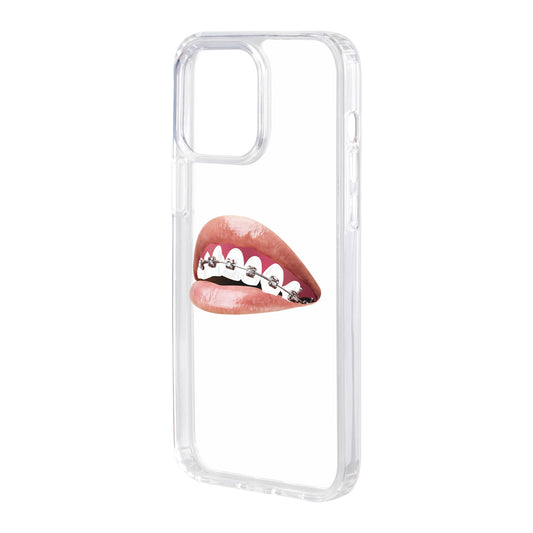 ORTHODONTIST-iPhone 15 Pro Max Solid Kılıf