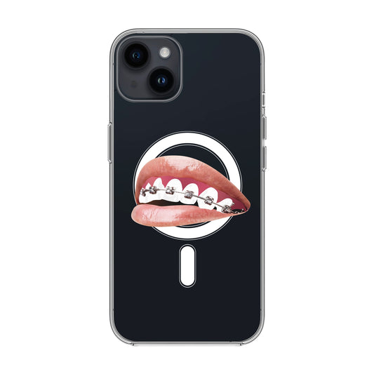 ORTHODONTIST-iPhone 11 Pro Max Solid Kılıf MagSafe Özellikli