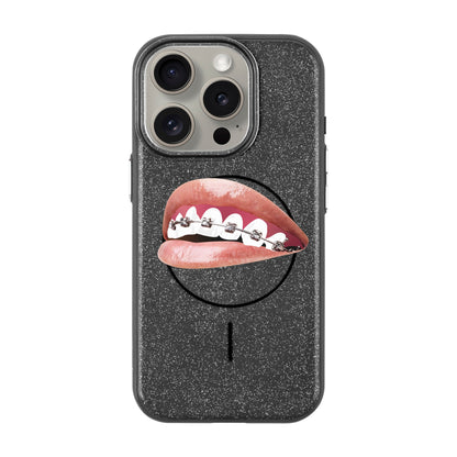 ORTHODONTIST-Radiant Kılıf MagSafe Özellikli - iPhone 15 Pro