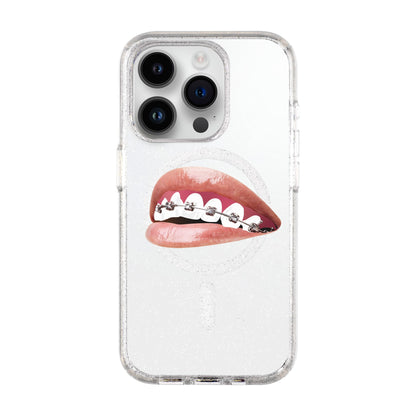 ORTHODONTIST-iPhone 14 Pro Shiny Kılıf MagSafe Özellikli