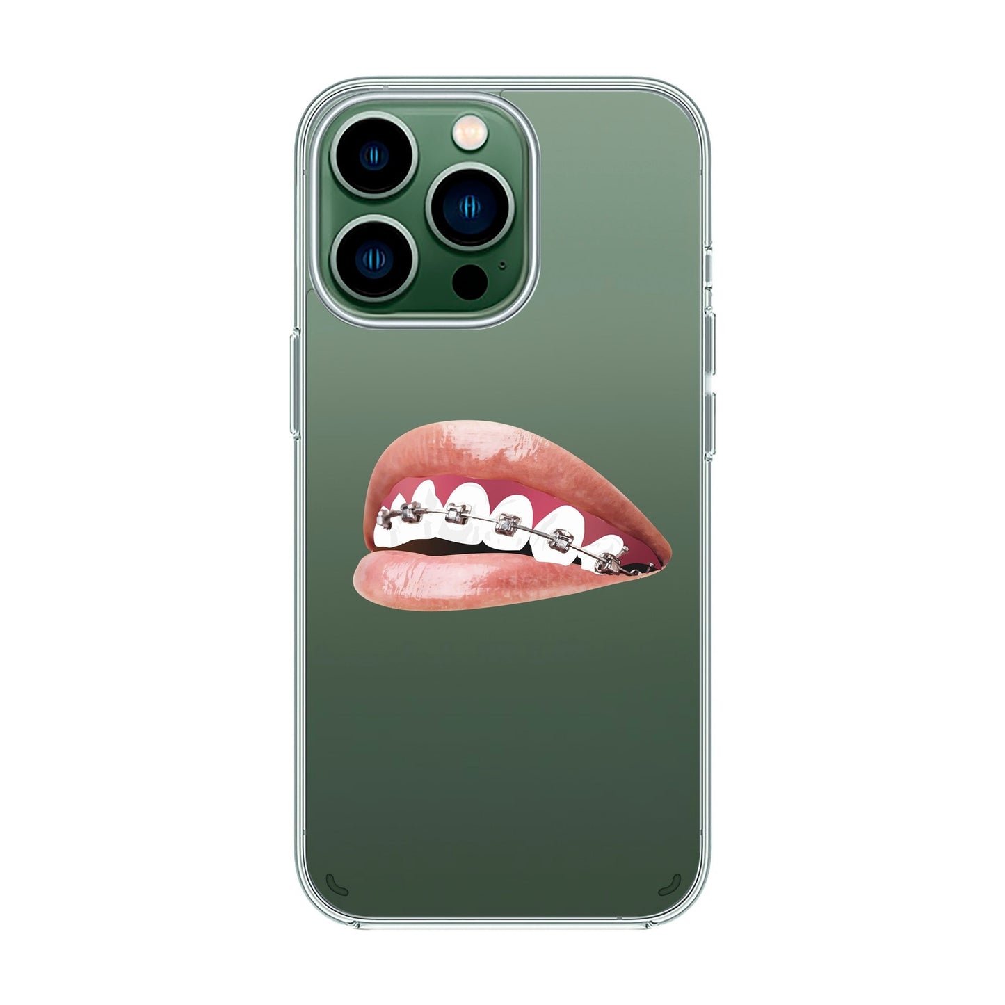 ORTHODONTIST-iPhone 12 Pro Max Solid Kılıf