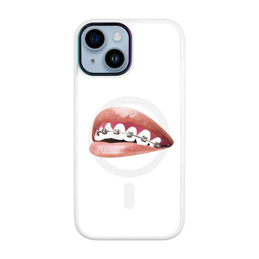 ORTHODONTİST-iPhone 12 Vigor Kılıf MagSafe Özellikli