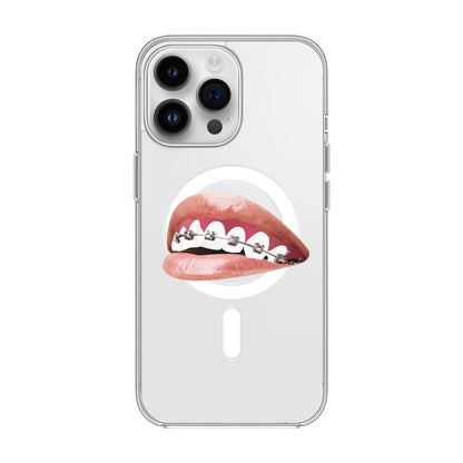 ORTHODONTIST-iPhone 14 Pro Max Solid Kılıf MagSafe Özellikli