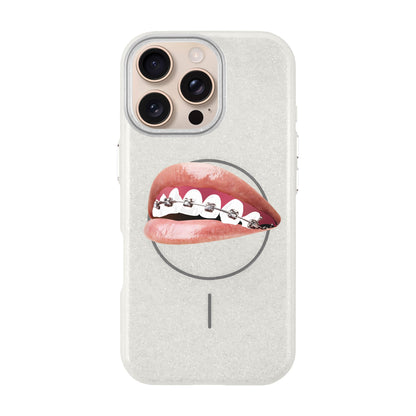 ORTHODONTIST-iPhone 16 Pro Max Radiant Kılıf MagSafe Özellikli