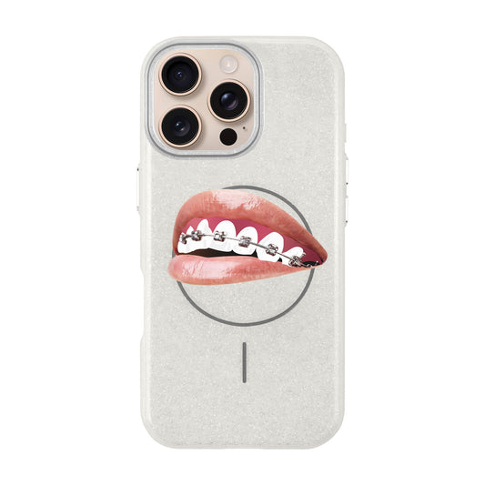 ORTHODONTIST-iPhone 16 Pro Max Radiant Kılıf MagSafe Özellikli