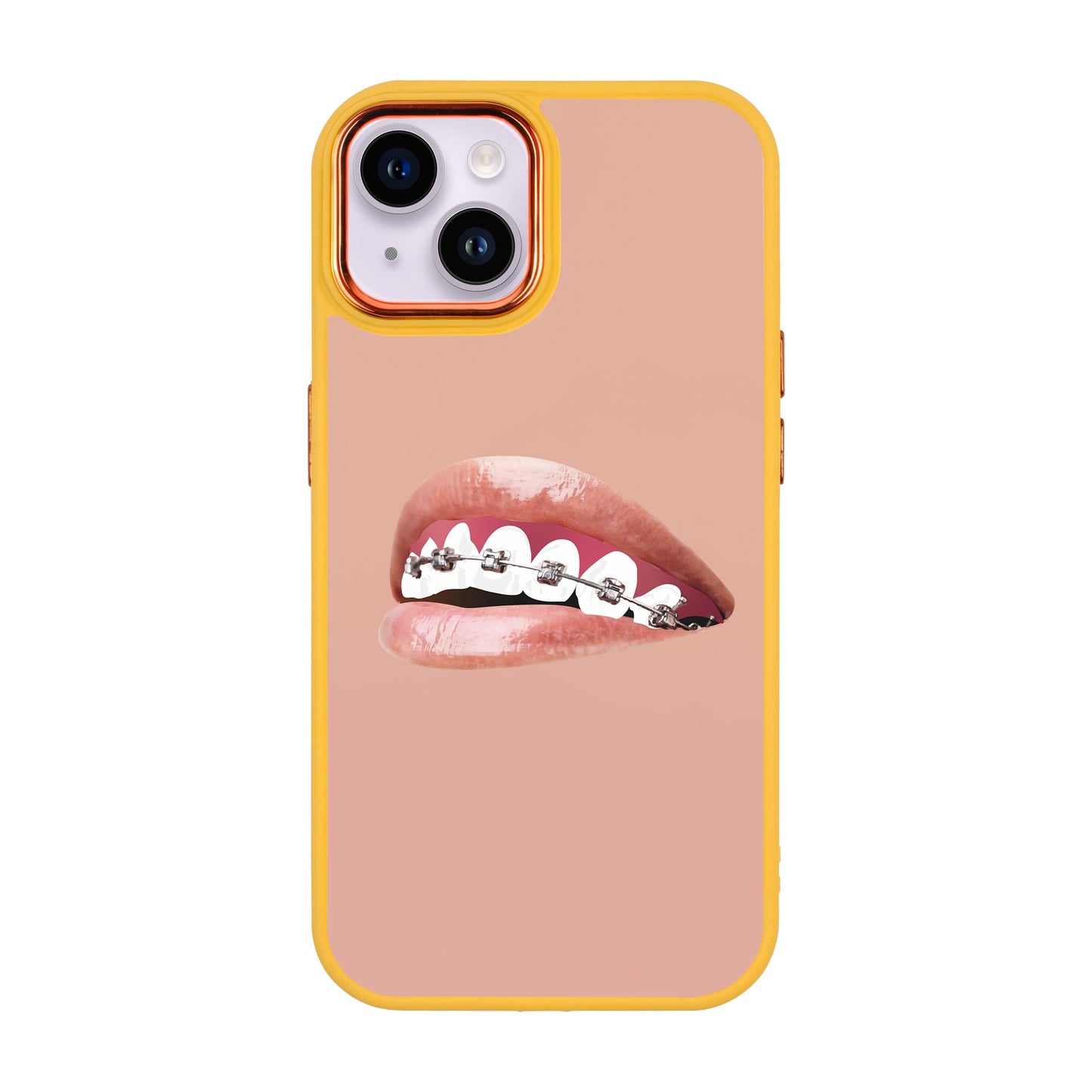 ORTHODONTIST-iPhone 14 Plus Proof Kılıf