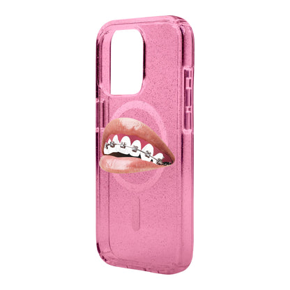 ORTHODONTIST-iPhone 15 Pro Max Shiny Kılıf MagSafe Özellikli