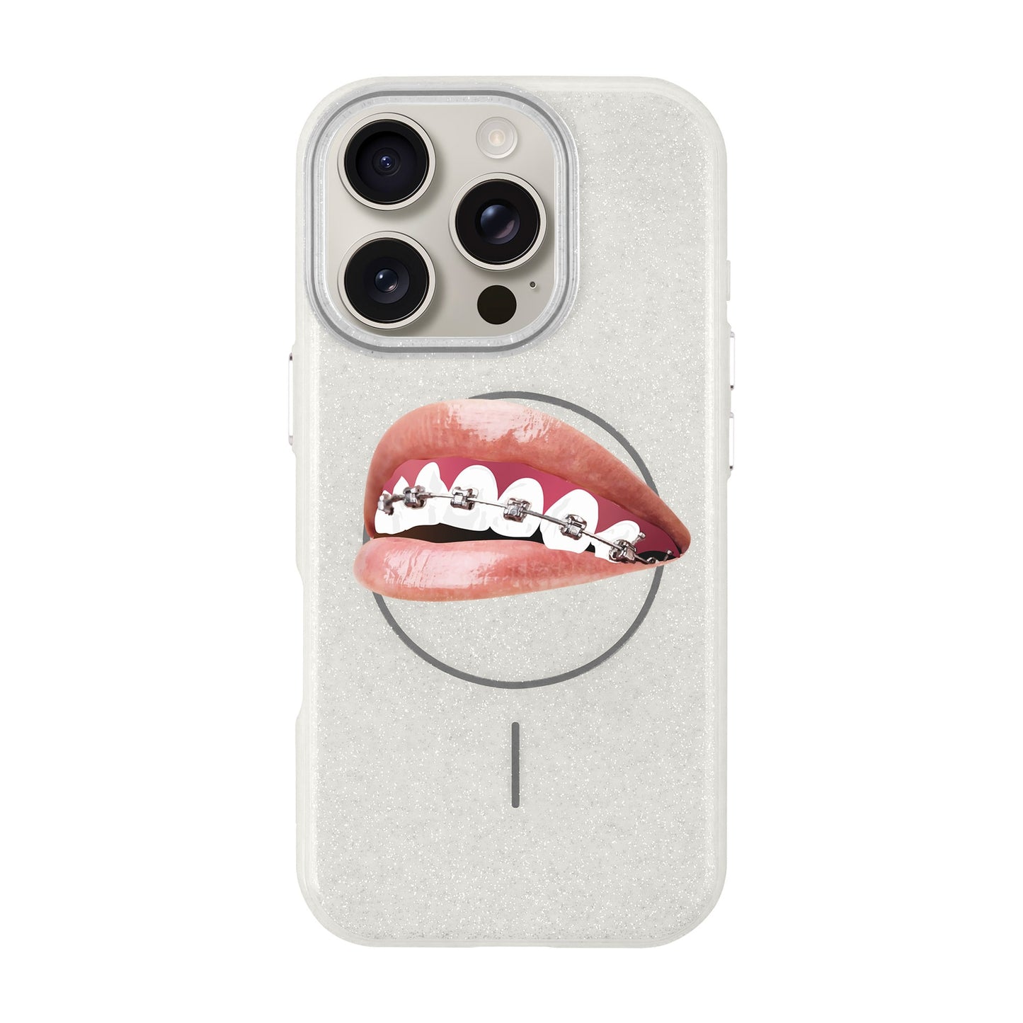 ORTHODONTIST-iPhone 16 Pro Radiant Kılıf MagSafe Özellikli