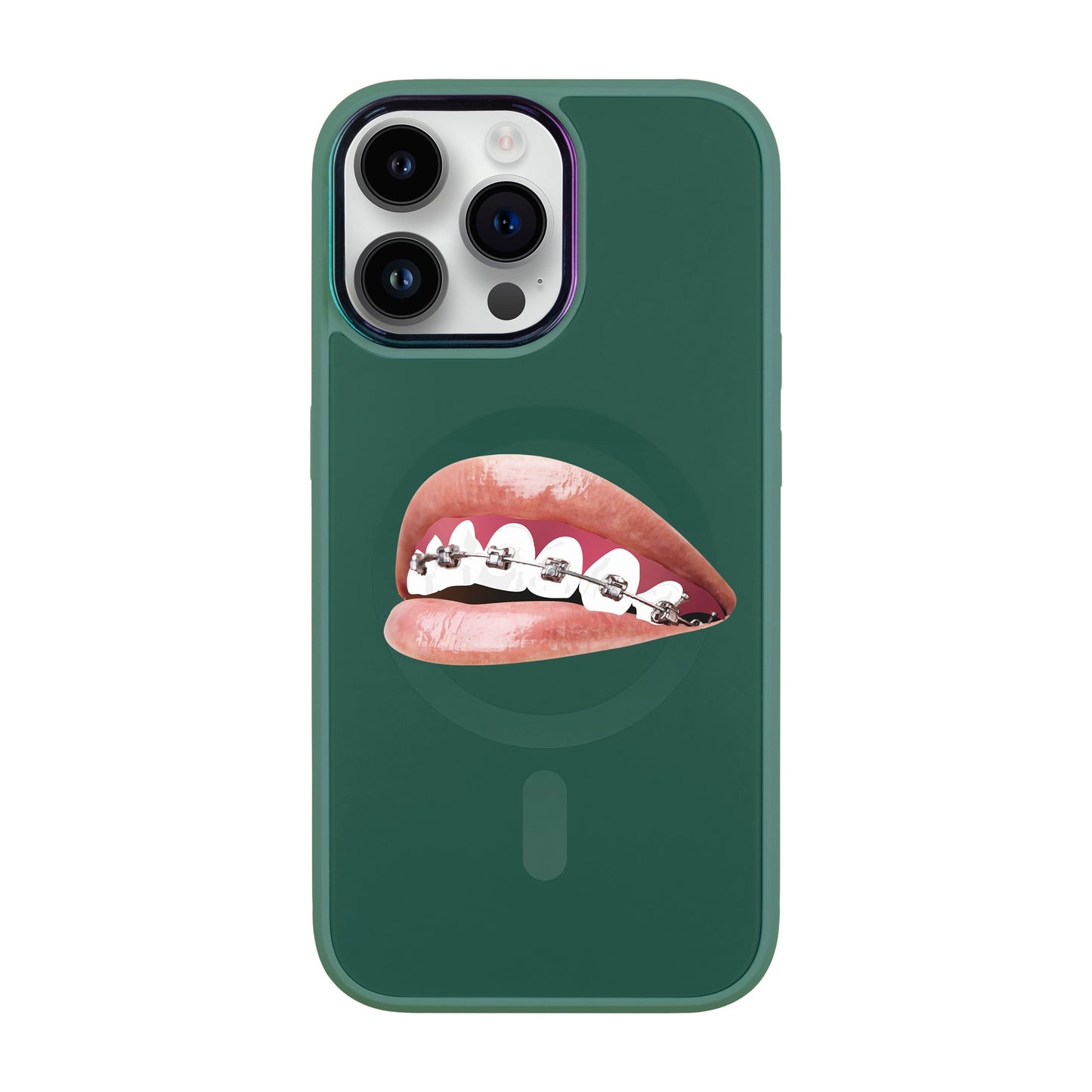 ORTHODONTİST-iPhone 14 Pro Max Vigor Kılıf MagSafe Özellikli