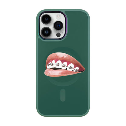 ORTHODONTİST-iPhone 14 Pro Max Vigor Kılıf MagSafe Özellikli