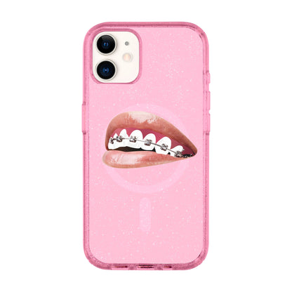 ORTHODONTIST-iPhone 11 Shiny Kılıf MagSafe Özellikli