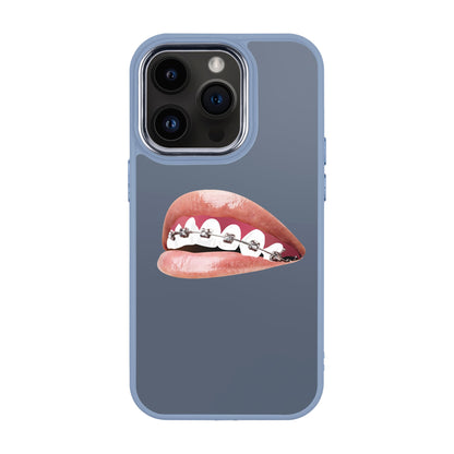 ORTHODONTIST-iPhone 14 Pro Proof Kılıf