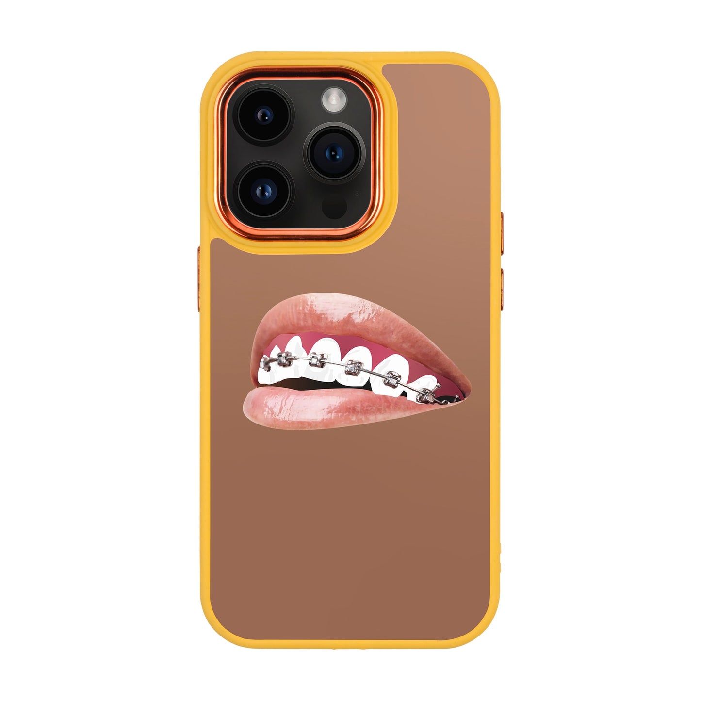 ORTHODONTIST-iPhone 14 Pro Proof Kılıf
