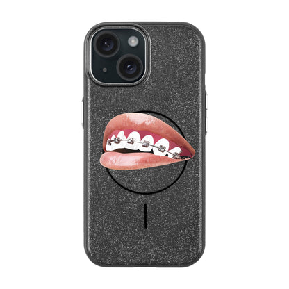 ORTHODONTIST-iPhone 15 Plus Radiant Kılıf MagSafe Özellikli