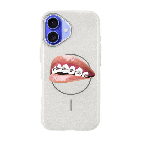 ORTHODONTIST-iPhone 16 Radiant Kılıf MagSafe Özellikli