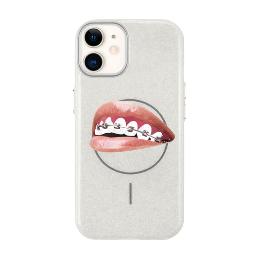 ORTHODONTIST-iPhone 11 Radiant Kılıf MagSafe Özellikli