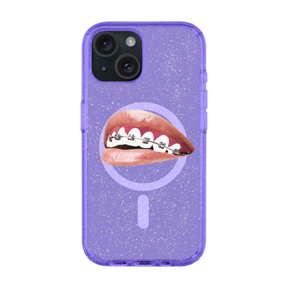 ORTHODONTIST-iPhone 15 Plus Shiny Kılıf MagSafe Özellikli