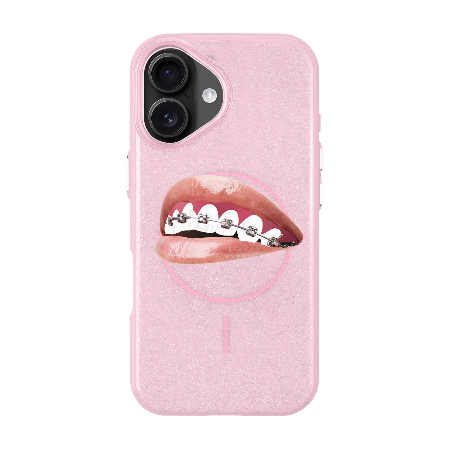 ORTHODONTIST-iPhone 16 Radiant Kılıf MagSafe Özellikli