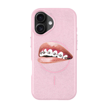 ORTHODONTIST-iPhone 16 Radiant Kılıf MagSafe Özellikli