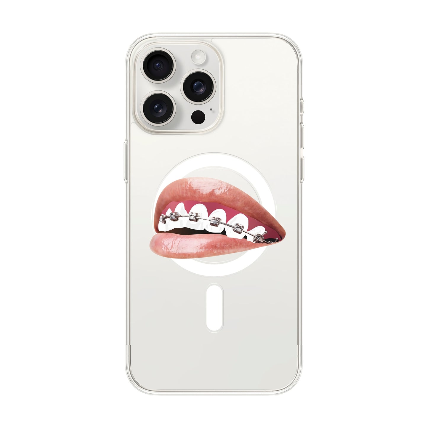 ORTHODONTIST-iPhone 15 Pro Max Solid Kılıf MagSafe Özellikli