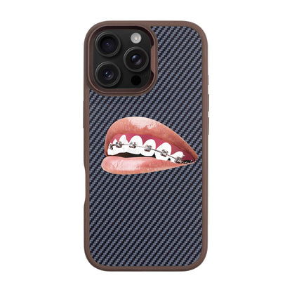 ORTHODONTIST-iPhone 16 Pro Max Plaid Kılıf MagSafe Özellikli