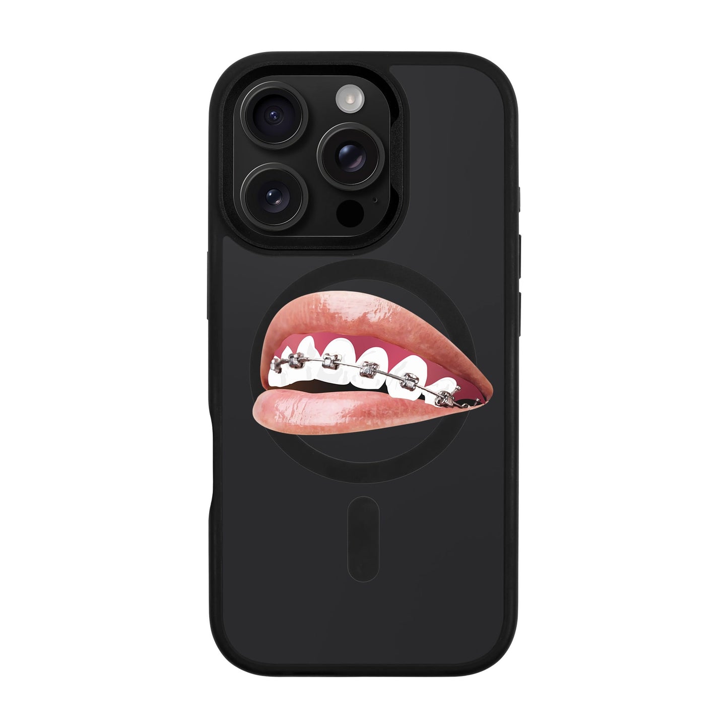 ORTHODONTIST-iPhone 16 Pro Rise Kılıf MagSafe Özellikli