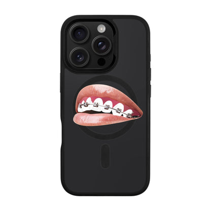ORTHODONTIST-iPhone 16 Pro Rise Kılıf MagSafe Özellikli