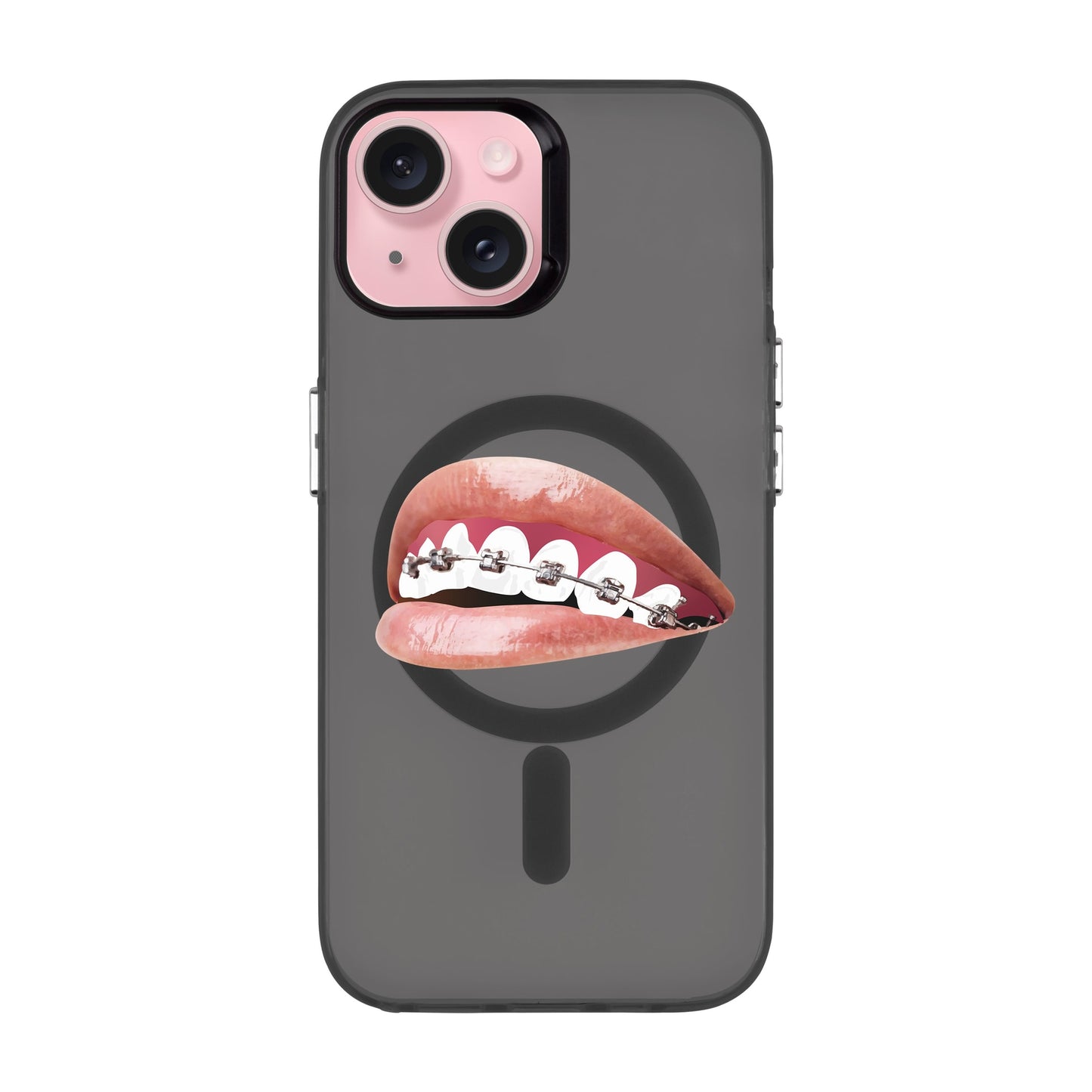 ORTHODONTIST-iPhone 15 Hold Kılıf MagSafe Özellikli