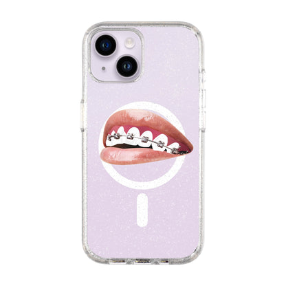 ORTHODONTIST-Shiny Kılıf MagSafe Özellikli - iPhone 14