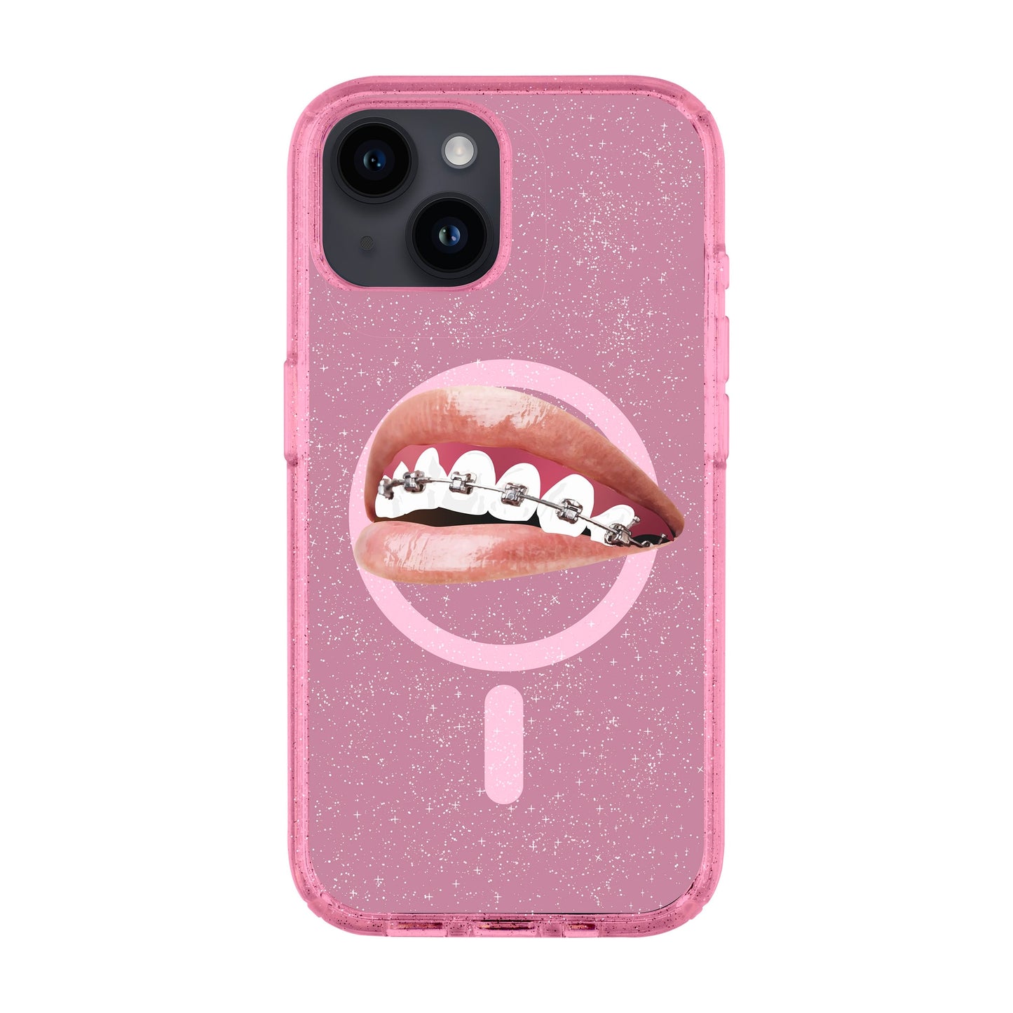 ORTHODONTIST-Shiny Kılıf MagSafe Özellikli - iPhone 14