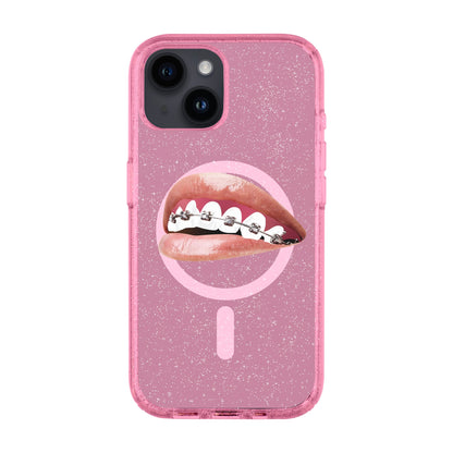 ORTHODONTIST-Shiny Kılıf MagSafe Özellikli - iPhone 13