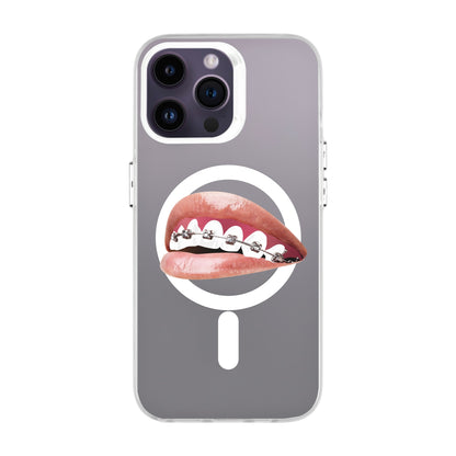 ORTHODONTIST-iPhone 14 Pro Max Hold Kılıf MagSafe Özellikli