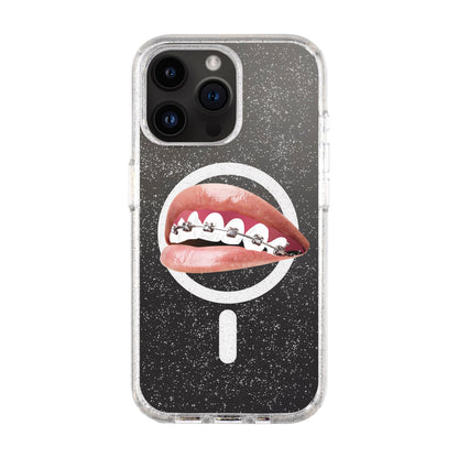 ORTHODONTIST-iPhone 14 Pro Max Shiny Kılıf MagSafe Özellikli