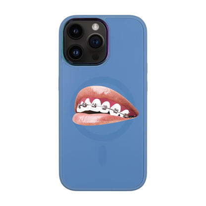 ORTHODONTİST-iPhone 14 Pro Max Vigor Kılıf MagSafe Özellikli