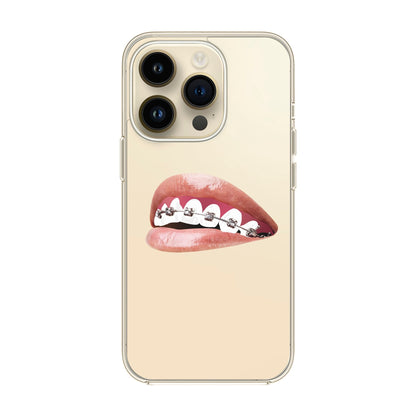 ORTHODONTIST-iPhone 14 Pro Solid Kılıf