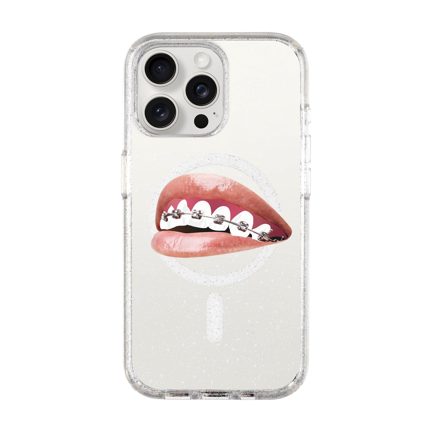 ORTHODONTIST-iPhone 15 Pro Max Shiny Kılıf MagSafe Özellikli