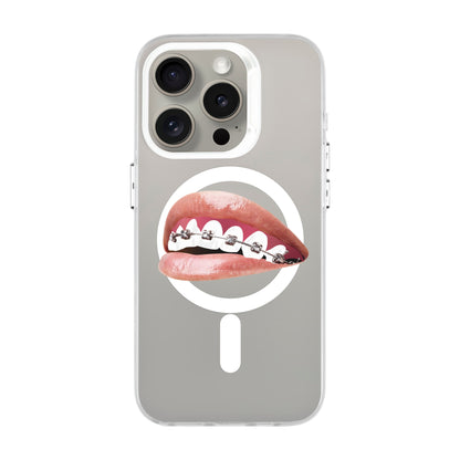 ORTHODONTIST-iPhone 15 Pro Hold Kılıf MagSafe Özellikli