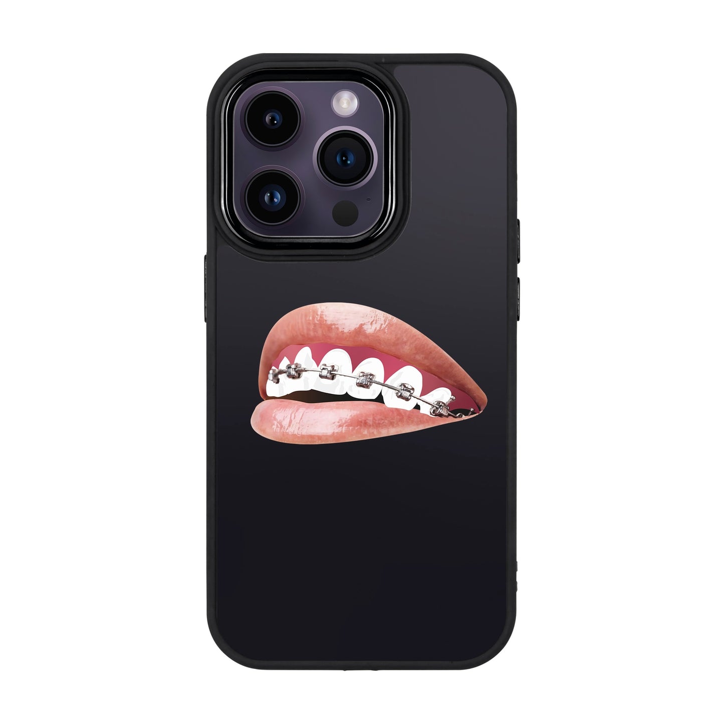 ORTHODONTIST-iPhone 14 Pro Proof Kılıf