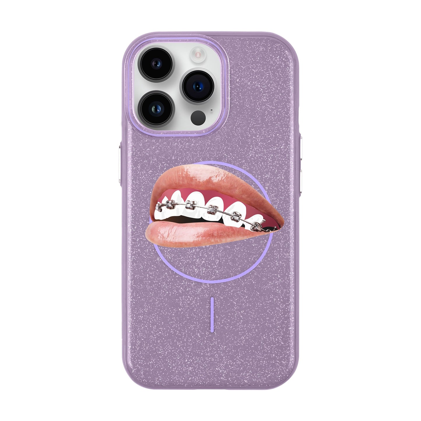 ORTHODONTIST-iPhone 14 Pro Max Radiant Kılıf MagSafe Özellikli